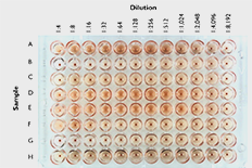 AI 혈구응집시험