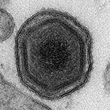 ASF 바이러스 전자현미경 사진