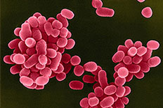 브루셀라균(Brucella abortus) 현미경 사진