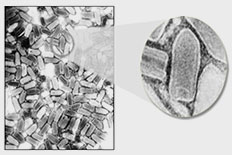 광견병 바이러스 전자현미경 사진